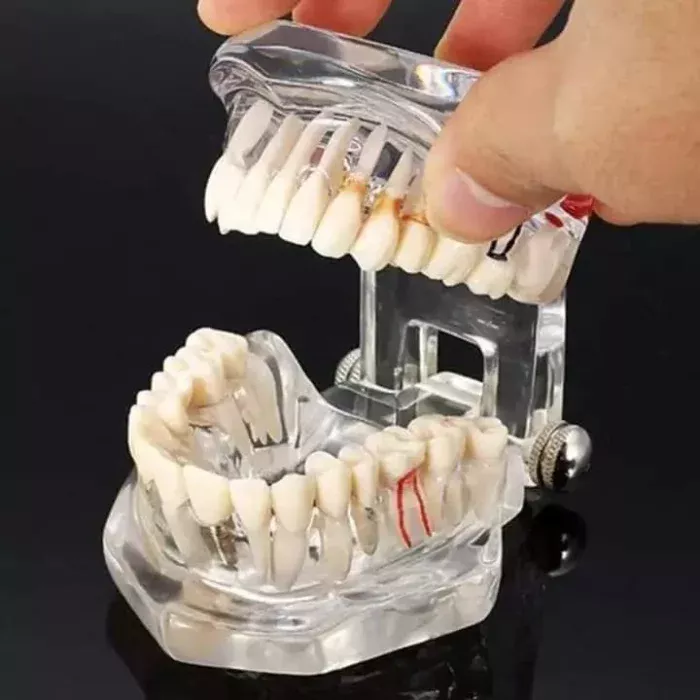 Dental Restoration with implant all in one model - Image 1