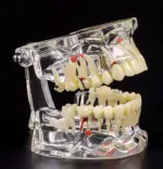 Dental Restoration with implant all in one model - Image 3