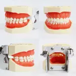 Dental Typodont Model Removable Teeth With Articulator - Image 2