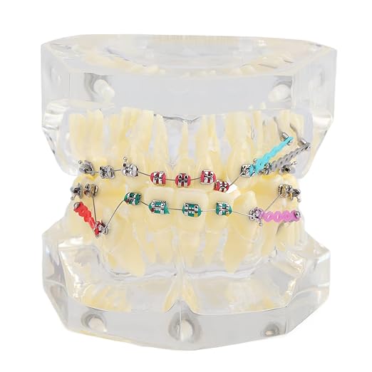 Study model Wire Chain - Image 1