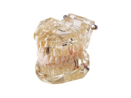 dental-model-for-patient-education