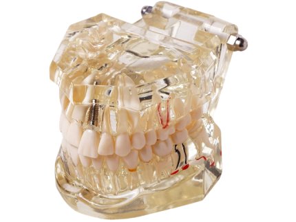 Teeth Model