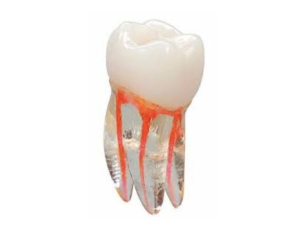 endo-tooth-practice.